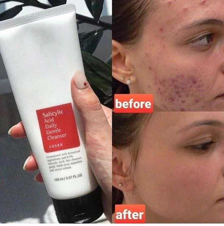 cosrx salicylic acid daily gentle cleanser | 150 ml cosrx salicylic acid daily gentle cleanser | 150 ml